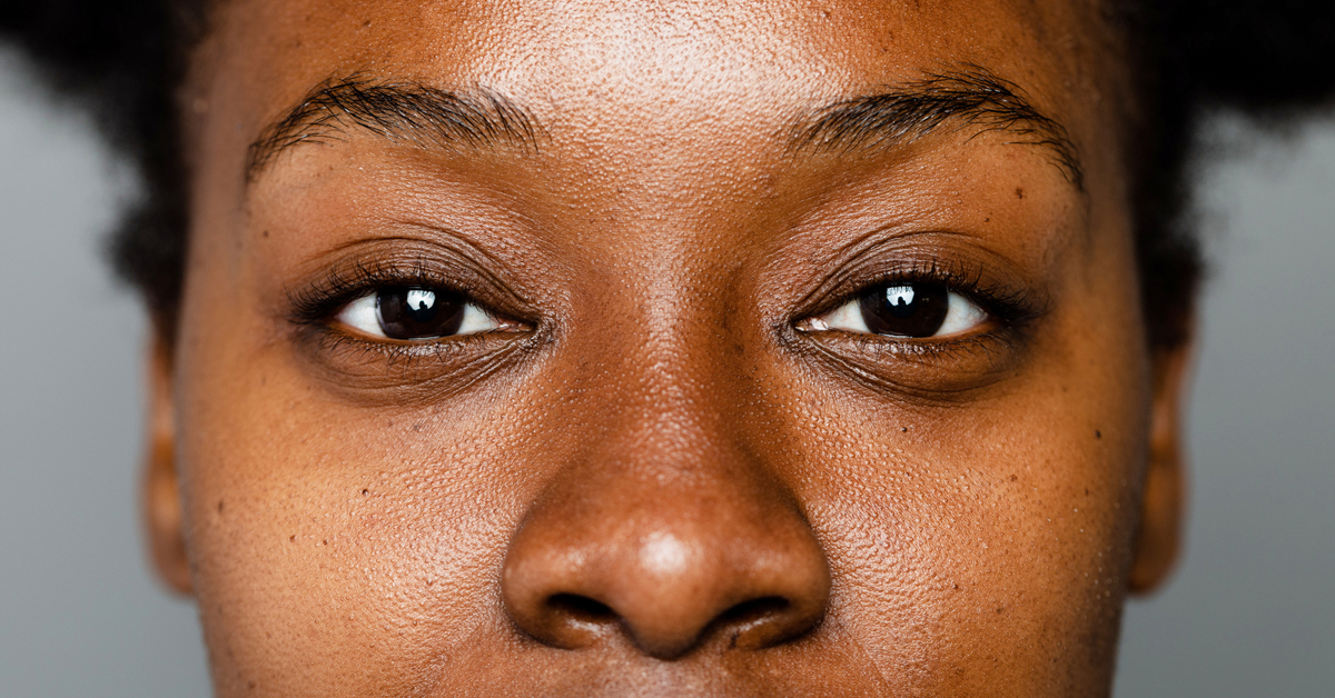 What to Avoid to How To Get Even Skin Tone For Black Skin